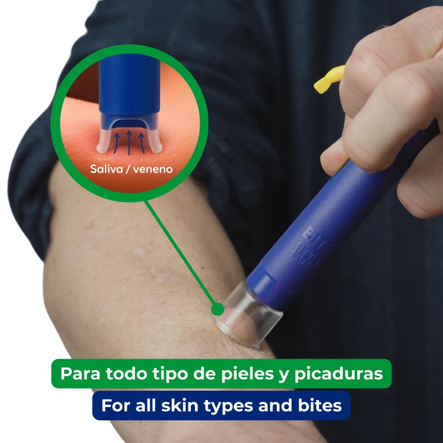 Bite Sucker aspiratore punture insetti a suzione riusabile